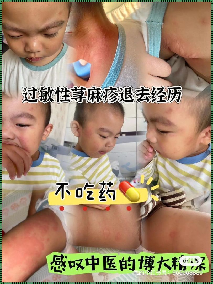 儿童荨麻疹一般持续几天：关爱与呵护
